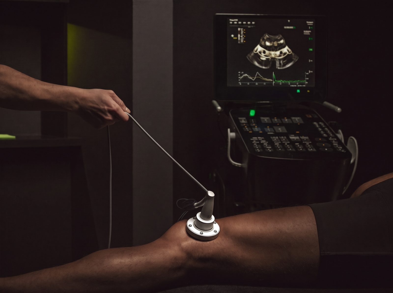 Fisioterapeuta realizando una ecografía musculoesquelética del tendón rotuliano