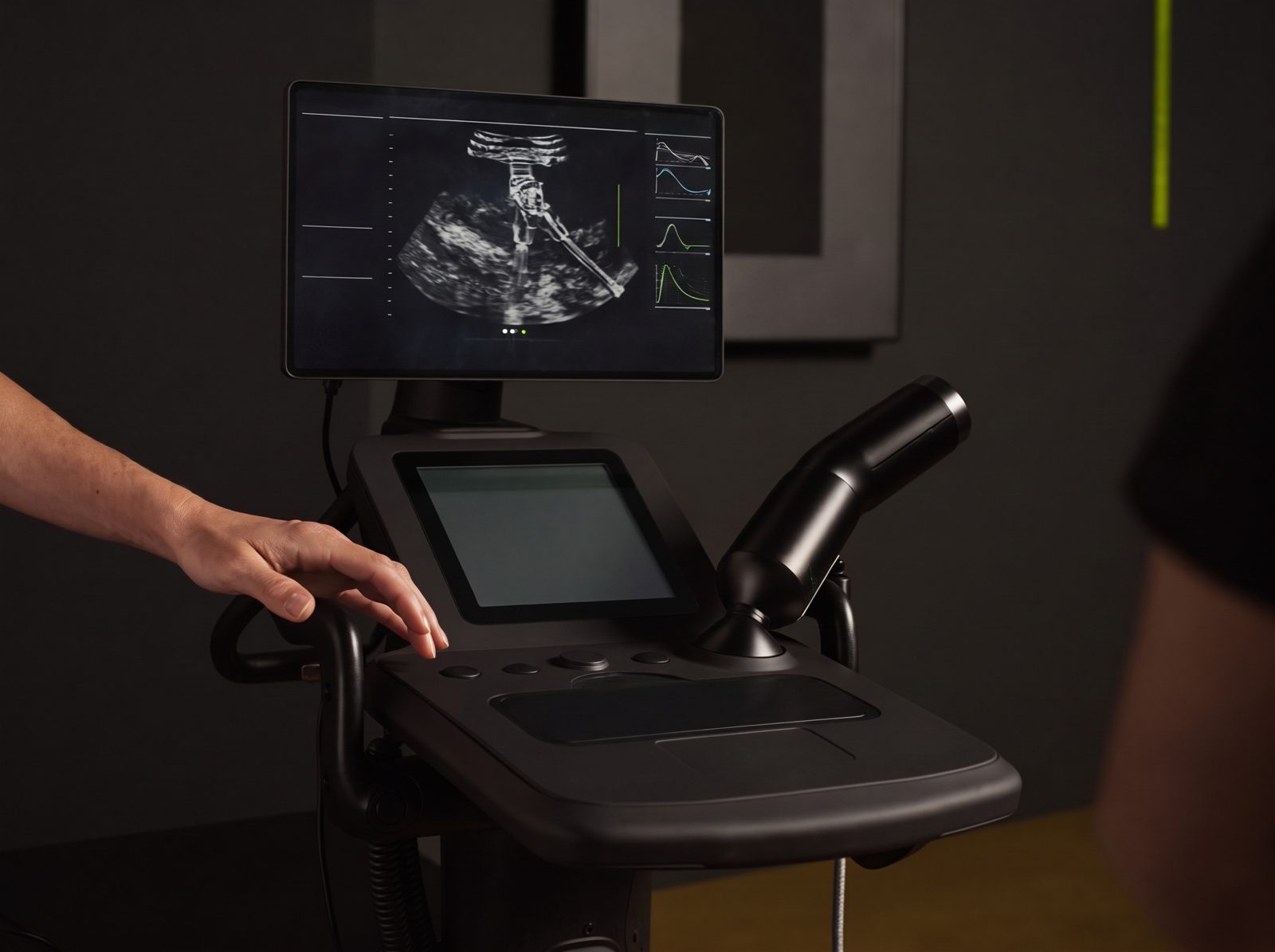 Ecografía musculoesquelética de alta resolución